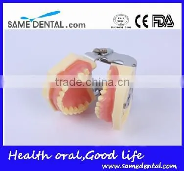 Dental Moderate Periodontal Disease Model Teaching Demonstration photo-5