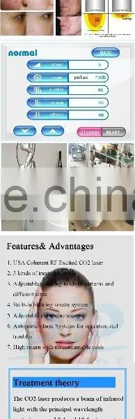 Spot Scar Pigment Removal Fractional Co2 Fractional Laser Vaginal Tightening Machine& Stretch Mark 40w Removal Acne Scar Removal Machine Laser Equipment Co2 Fractional Laser Acne Scar Removal photo-6