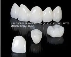 Dental Pfm Crown From China Dental Lab photo-4