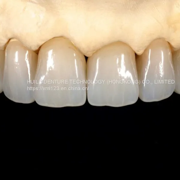 Crown & Bridge A Professional Outsourcing Dental Lab. photo-3
