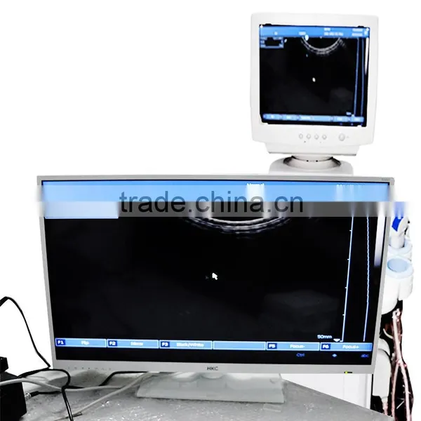 CE ISO Approved White Color Full Digital Trolley Ultrasound Scanner photo-5