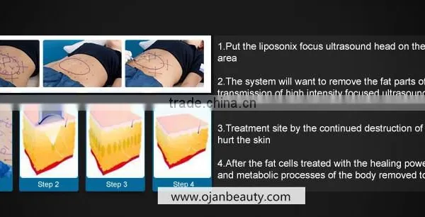 2016 Best Weight Loss Machine Liposunix Slimming Fat Removal / Liposunix Slimming Machine photo-4