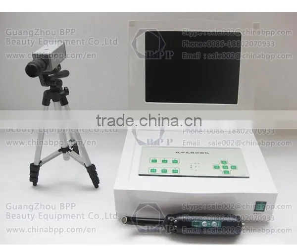 Infrared Mammary Gland Diseases Detector Women Breast Biopsy Analyzer Machine photo-2