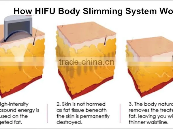 2016 B-028 GLM Liposlim Beauty Eqiupment Hifu Beauty/hifu Multi-polar RF For Body/hifu Slimming Machine With CE For Sale 0.1-2J photo-5