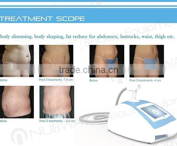 Skin Rejuvenation Hot Sales ! MIni Portable Home Skin Lifting HIFU Liposuction Fat Reduction Ultrasound Machines 2000 Shots photo-5