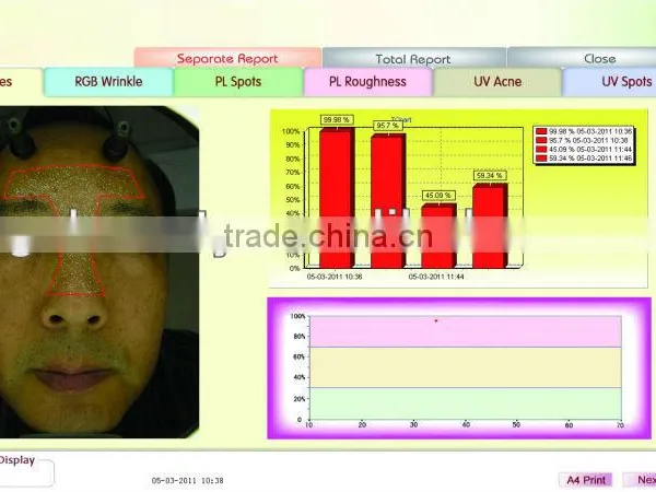 WT-03-B Big Facial Skin Analyzer Magic Mirror photo-5