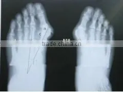 Agfa Dry Medical Film, X-ray Accessories Sale From Manufacturer, Medical Equipment Used in Hospital