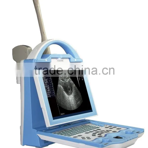 Cheap Veterinary Ultrasound Scanner Manufacture KX5600 photo-2