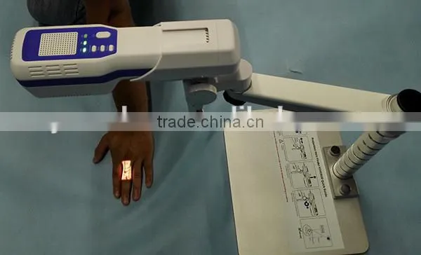 Good Price Easy Operate Medical Injection Portable Projection Vein Finder photo-3