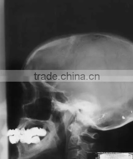 Medical Dry Films,medical Films.fuji Dry Film photo-3