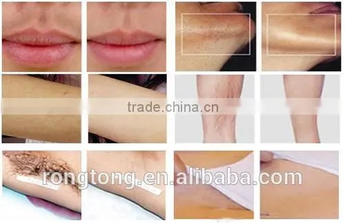 Led Skin Rejuvenation Device Perfect Permanent Hair Removal Light Laser Spot Acne photo-5