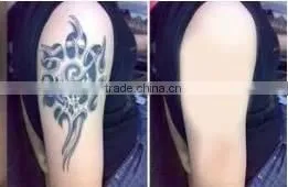 Varicose Veins Treatment Distributors Wanted Tattoo Remover Q Switched 800mj Nd Yag Laser Tattoo Removal Machine/laser Tattoo Removal Machine Price photo-6