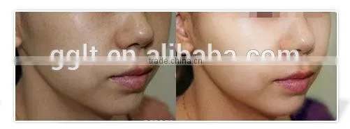 Merry Christmas Biggest Discount! Wholesale Skin Beauty Mesotherapy Injector Gun From Korea photo-5