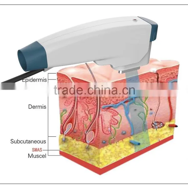 High Intensity RF Machine for Skin Tightening Face Lifting photo-2