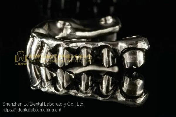 Full-arch Implant Bridge Prosthesis, Implant Denture Framework, Implant Prosthesis, Laboratoire Dentaire, Dentallabor, Laboratorio Dental, Dental Laboratory, Shenzhen LJ Dental Lab China photo-2