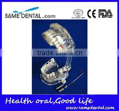 Dental Adult Pathological Dentition Model DEA-48 Teeth Model Teaching Demonstration photo-3