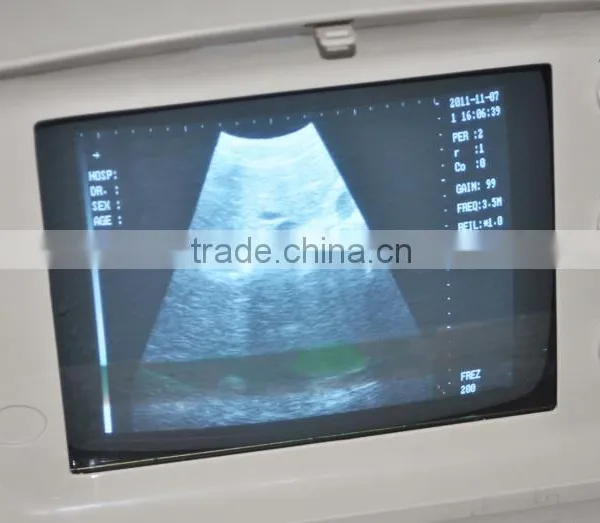 2016 CE Approved Digital Portable Style Ultrasound Machine/Scanner With Cheap Price photo-2