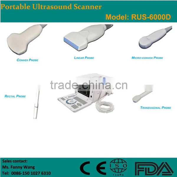 Digital Portable Ultrasound Scanner photo-2