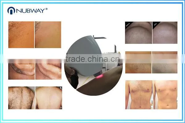 Over 20 Million Flashes Painless and Permanent Depilator Professional Cooling System Diode Laser 808nm Hair Removal Machine photo-2