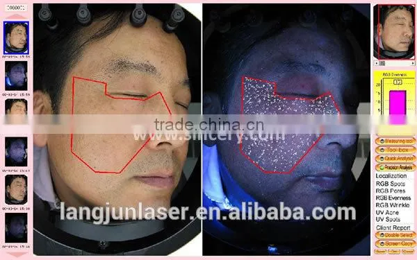 Facial Skin Scanner Analyzer / Sam Skin Analyzer Machine photo-4