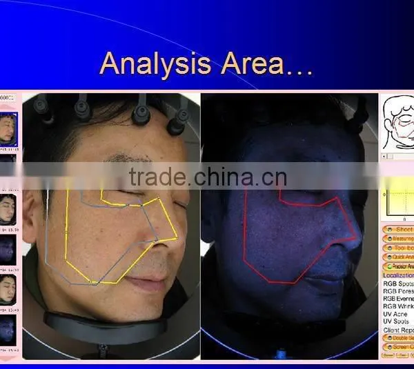 Hot New Products for 2014 Digital Skin Analyzer photo-2