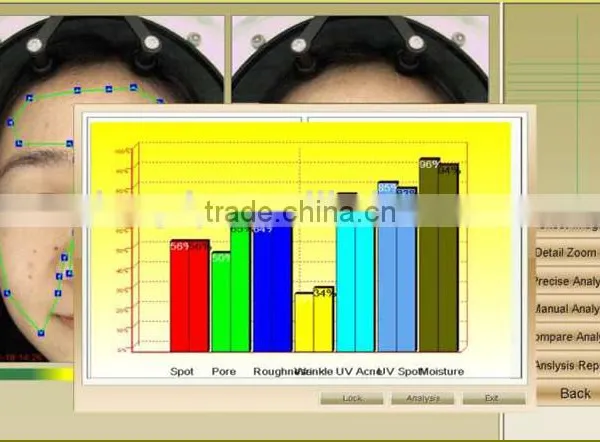 Professional Face Skin Test Machine !!!High Quality Skin Analyzer Visia Skin Analysis Machine photo-5
