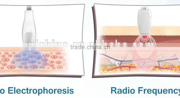 Radio Frequency Mesotherapy Beauty Facial Electroporation for Wrinkles Device - New Cellactor photo-4
