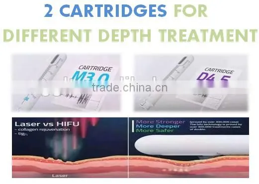Forehead Wrinkle Removal Happy Near Year! Pop HIFU Nasolabial Folds Removal Vaginal Tightening Machine For Factory Price photo-3