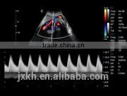 CE ISO Approved Medical 15 Inch LCD Monitor 3D 4D Trolley Color Doppler Ultrasound Scanner photo-6