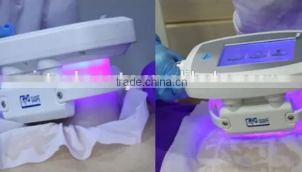 Cryo Fat Removal Cryo of Lipolysis Slimming Machine photo-4