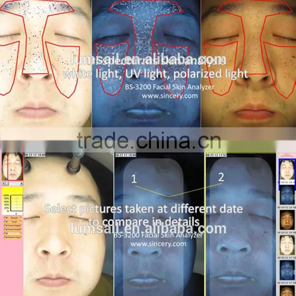 Portable Facial Skin Scanner Analyzer 3D Facial Skin Analysis photo-5