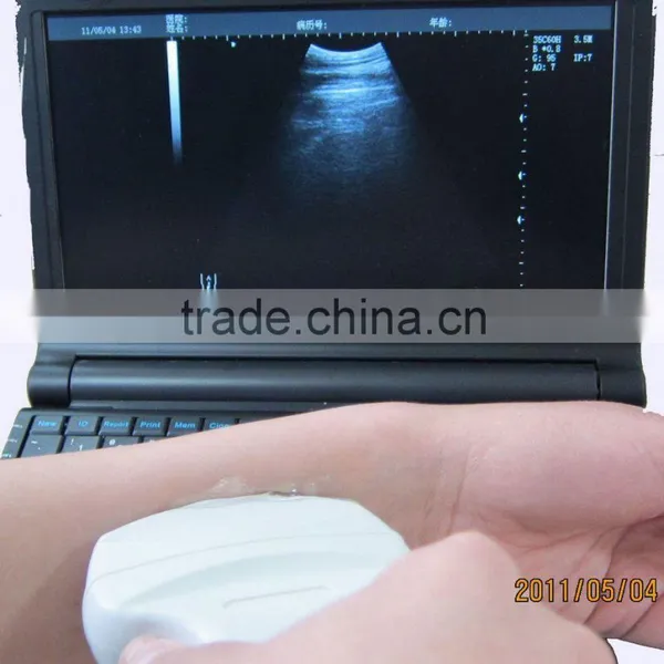 Factory Price! CE Approved Cheap Ultrasound Scanner With 3.5Mhz Convex Probe photo-2