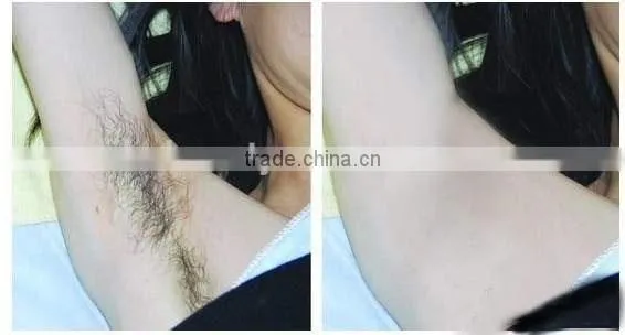 Mona SH-960 Ipl Hair Removal Machine(ipl+shr+elight) photo-6