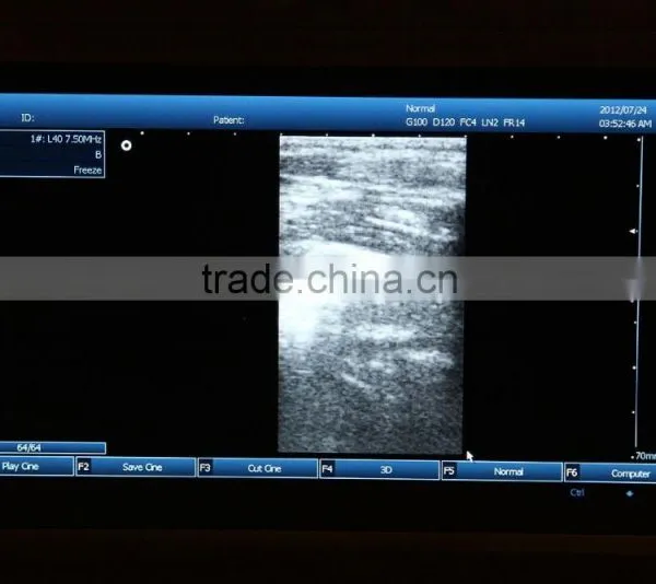 Cheapest Large Screen Good Image Laptop Ultrasound Scanner Machine With Probe-3&D External Workstation-RUS-9000E2 photo-3