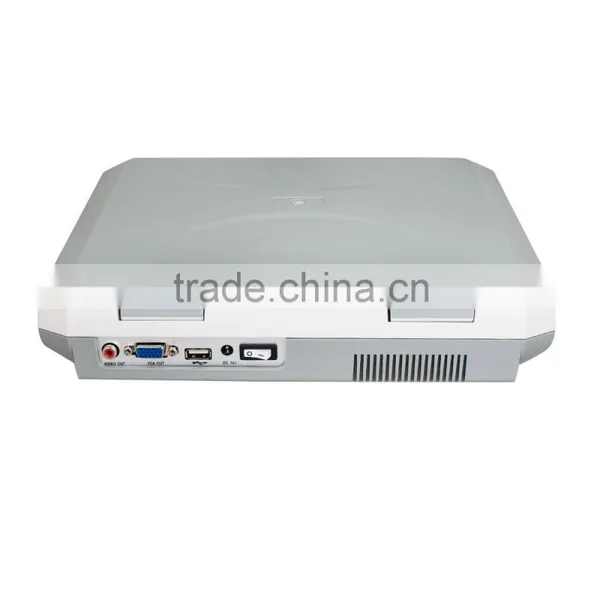 CE Laptop Ultrasound Machine With Multi Frequency Probe Ultrasonic Diagnostic System RUS-9000F2 photo-4