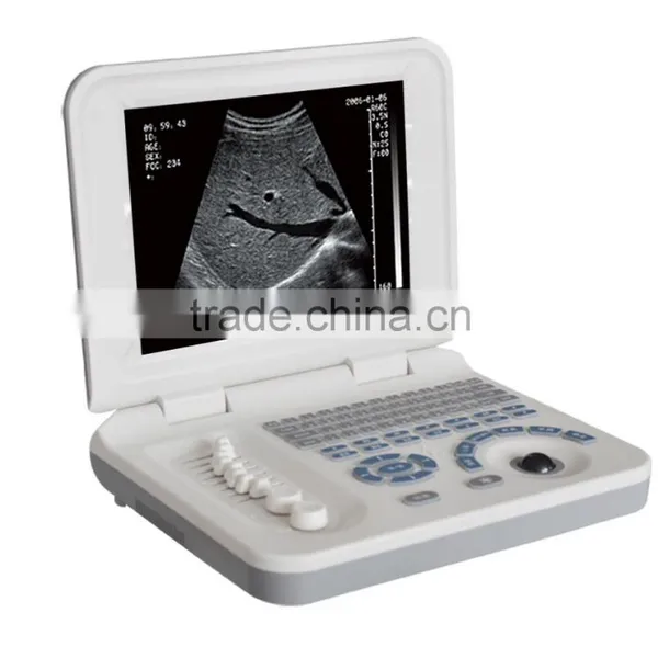 Ultrasound Equipments & Laptop Ultrasonic Machine 3018 photo-3