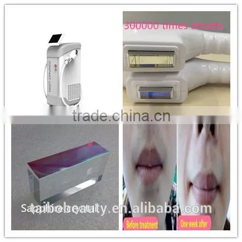 Taibo Mona 960 Ipl Shr Laser Hair Removal Machine/e-light Laser Hair Removal Machine for Sale photo-2