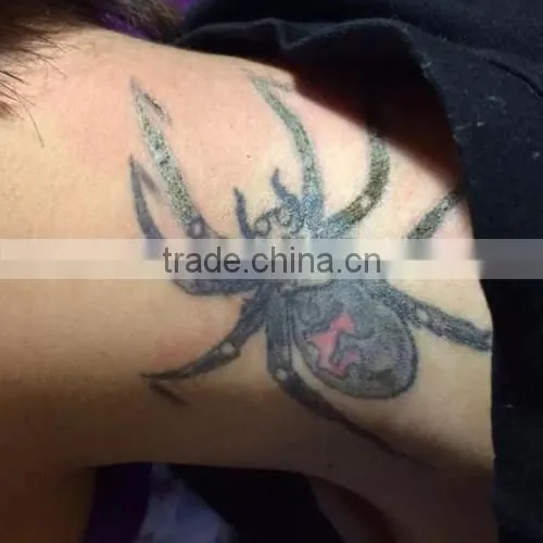Tattoo Removal Laser Machine Q Switch Tattoo Removal Mongolian Spots Removal Machine/nd Yag Long Pulse Laser Telangiectasis Treatment photo-4