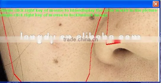 Portable Dialysis Machine/facial Skin Analyzer Machine Skin Scan/skin Analyser for Face photo-6