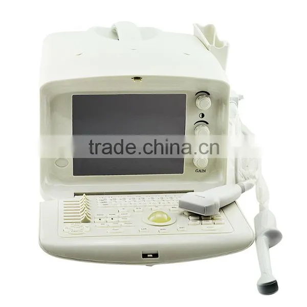2016 Best Seller CE Approved Fully Digital Portable Ultrasound Machine /scanner photo-5