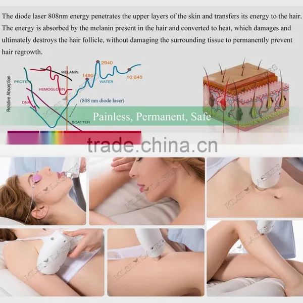 Promotion Laser Alma Soprano Diode 810nm Hair Epil Equipment photo-5