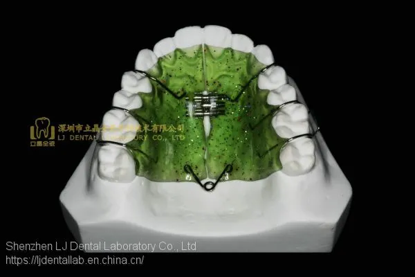 Space Expanders, Nance Appliance, Helix Appliance, Pendulum Appliance, ﻿﻿﻿﻿Porter Appliance, Fixed Lingual Expander, Sagittal Screw Appliance, Hyrax Rapid Palatal Expander, Orthodontic Retainers, Dental Orthodontic Appliance, Laboratoire Dentaire, Dentall