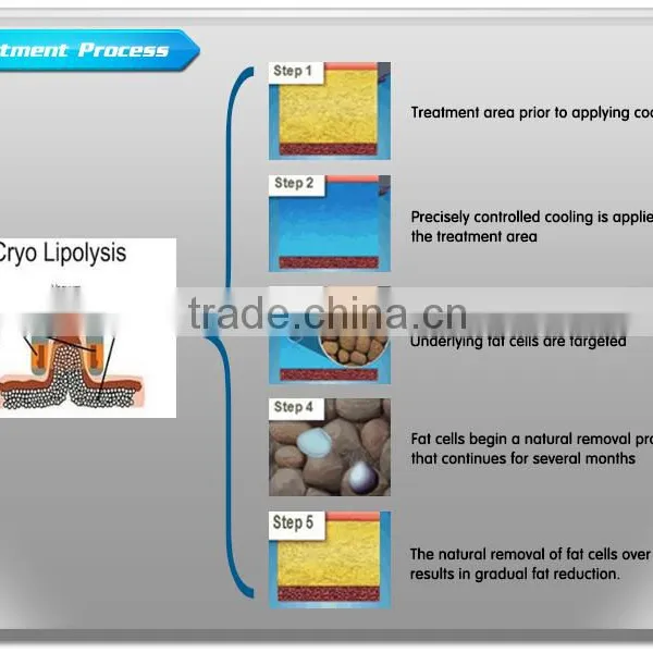 Best Portable Cryolipolysis Lipo Laser Slimming Cryo Weight Loss Kryolipolyse photo-5