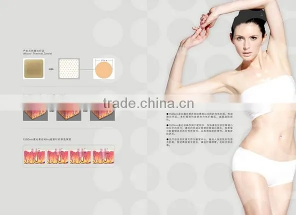 2016 Lowest Distributor Price: Super Pulse Co2 Laser for Skin Refreshing Scar Remov for Acne Scars Treatment , Burn Debridement photo-2
