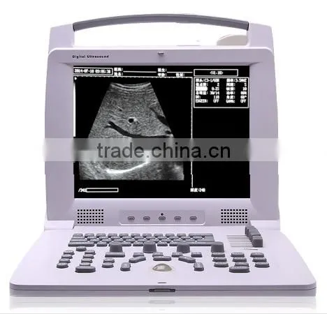 OB/GYN CE FDA Compact Multi-purpose Portable Doppler Ultrasound Scan photo-4