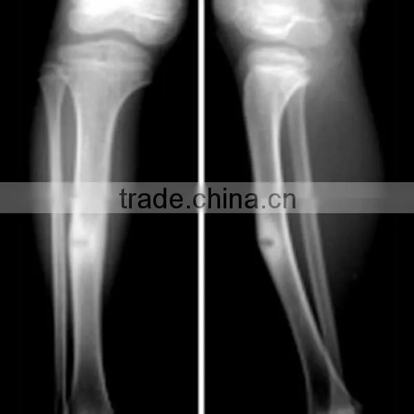X Ray Processor Film