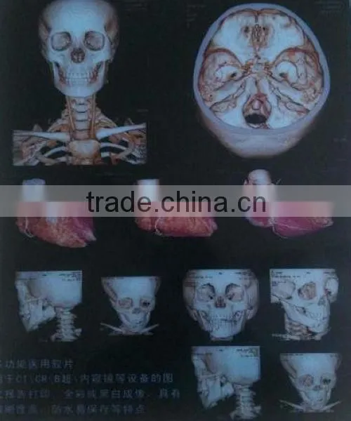 MQ Brand Good Quality Multi-function Medical pa Film photo-3