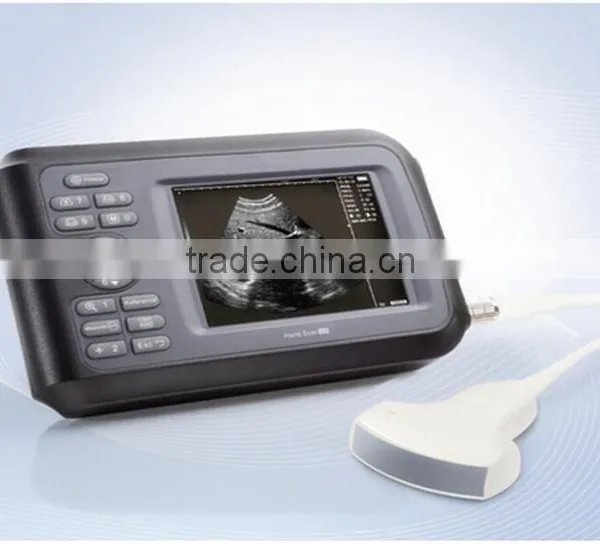 HandScan H8 Portable/palm Handheld Ultrasonic/ Ultrasound Machine Lower Price/medical Equipment photo-3