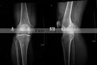 Dry Medical Thermal Dry Film KX410 X-ray Film Dry Film photo-4