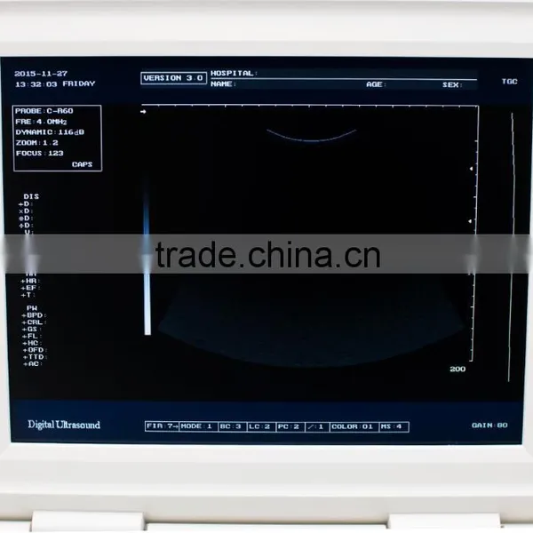 Ultrasonic, Optical, Electronic Equipments Laptop Portable B pc Based Ultrasound Scanner photo-6